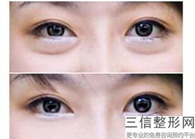 广东眼部整形民营医院入围前十!深圳美辰医疗美容医院实力超强