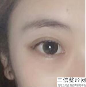 广东眼部整形民营医院入围前十!深圳美辰医疗美容医院实力超强