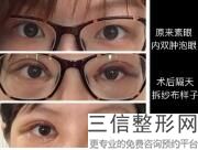 广州眼整形医生排名前十！李宗磊医生实力超强