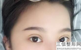 广州眼整形医生排名前十！李宗磊医生实力超强