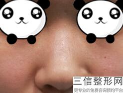 哈尔滨隆鼻整形医院排行榜前十！哈尔滨斯美诺整形医院排名靠前