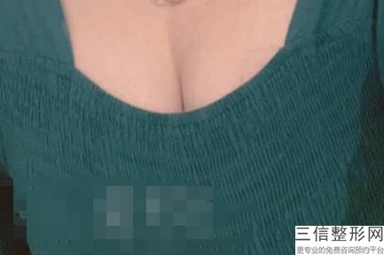 哈尔滨隆胸医院排名前十列表单！哈尔滨臻美整形医院实力超强