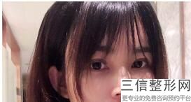 济南做双眼皮好的正规医院排名！首次上榜