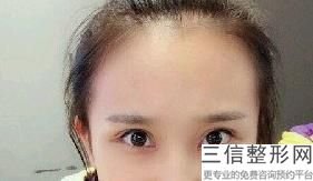 昆明割双眼皮医院排名前十！昆明丽都医疗美容医院排名靠前