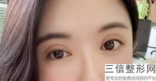 昆明割双眼皮医院排名前十！昆明丽都医疗美容医院排名靠前