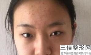 昆明双眼皮医生排行榜前七！排名靠前