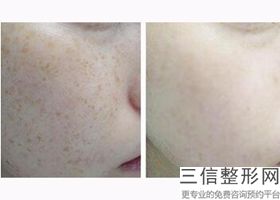 青岛拉皮整形医院排名前五！排名靠前