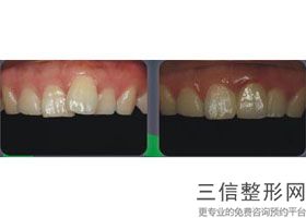 全国比较好的口腔医院排名前十名单公示！南京博韵口腔医院实力上榜