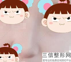 上海九院整形科隆鼻专家有哪些！魏皎医生排名靠前