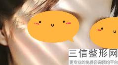 上海九院整形科隆鼻专家有哪些！魏皎医生排名靠前