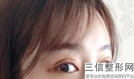 上海眼科医院排名前四公布！排名靠前