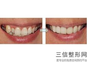 深圳口腔医院排名前十全面盘点！深圳美莱口腔口碑不错