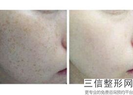 深圳拉皮比较出名的整形医院名单发布！遥遥领先