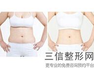 沈阳冷冻溶脂瘦大腿医院排名！位列前十