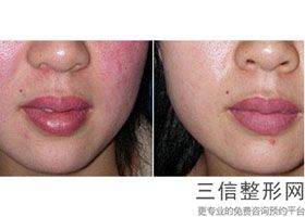 沈阳手术拉皮医院哪家好！沈阳省医整形医院首次上榜