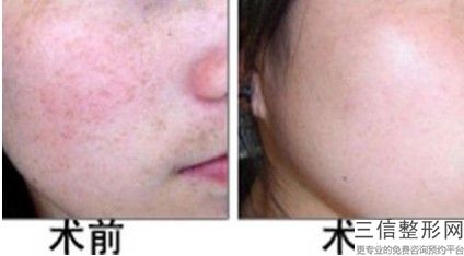 沈阳手术拉皮医院哪家好！沈阳省医整形医院首次上榜