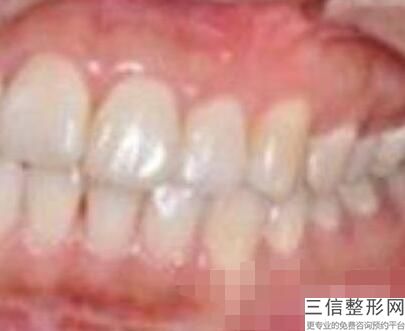 石家庄口腔专科医院排行榜前五位! 石家庄固德口腔门诊位列前十