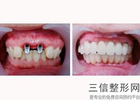 石家庄口腔专科医院排行榜前五位! 石家庄固德口腔门诊位列前十