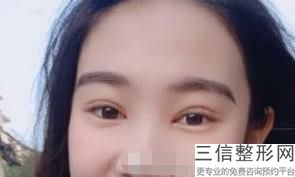 潍坊市飞秒激光近视眼手术整形医院排名！口碑良好