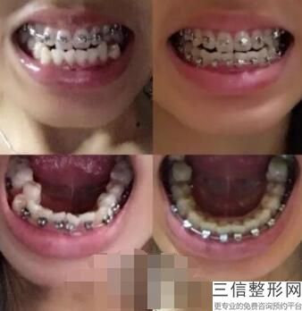 乌鲁木齐牙科医院排名前五！新疆自治区中医院口腔科医院口碑不错