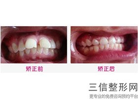 武汉口腔医院排行榜前十！武汉市雅贝康口腔连锁口碑不错