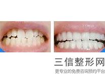 武汉口腔医院排名前十新版发布！武汉虎泉口腔医院实力入围