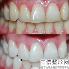 武汉口腔医院排名前十新版发布！武汉虎泉口腔医院实力入围