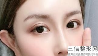 西安割双眼皮整形医院排行前十！西安画美医疗美容实力入围