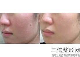 西安拉皮整形医院排行榜前十！ 西安西美整形外科位列前十