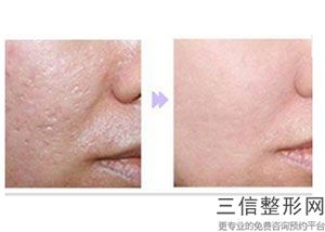 西安拉皮整形医院排行榜前十！ 西安西美整形外科位列前十