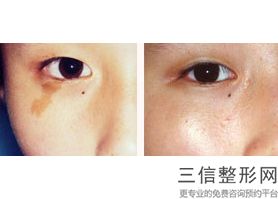 西安拉皮整形医院排行榜前十！ 西安西美整形外科位列前十