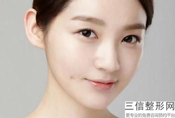 西安注射瘦脸哪家医院好！遥遥领先
