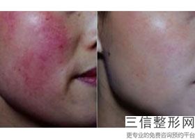 重庆拉皮手术医院排行前十！重庆当代医疗美容医院遥遥领先