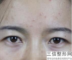 珠海双眼皮出名的整形医生排名前三！口碑不错