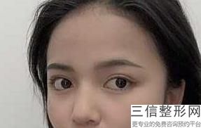 2022版重庆眼部综合整形医院排行榜前十！重庆术妍整形美容诊所锁定前十