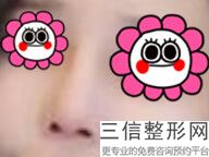 2022贵阳隆鼻整形医院排行榜前六选定！贵州俏致美整形美容医院口碑良好