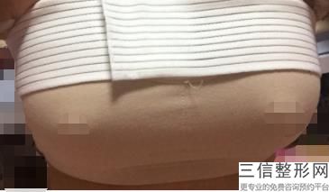 2022海口隆胸整形医院排行前十！海口美兰红妆医学美容门诊部口碑良好