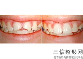 2022年西安磨骨医院排行榜！西安秦都口腔医院实力入围