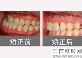 北京口腔正畸医生排名前十推荐！魏松实力入围