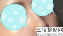 北京隆鼻整形医院排行前十推荐！北京米扬丽格医美医院实力上榜