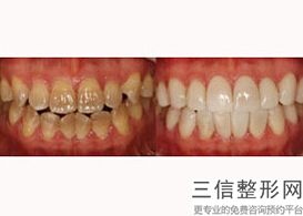 北京牙齿矫正医院排行前十！北京维乐口腔医院首次上榜
