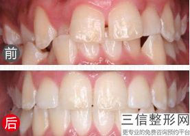 北京牙齿矫正医院排行前十！北京维乐口腔医院首次上榜