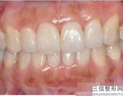 北京牙齿矫正医院排行前十！北京维乐口腔医院首次上榜