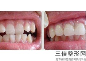 北京正畸口腔医院排名榜前十整理汇总！北京维恩口腔医院口碑不错