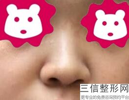 长沙整鼻子（隆鼻）良好的医院排名前六！ 长沙丽莎医学美容门诊部口碑良好