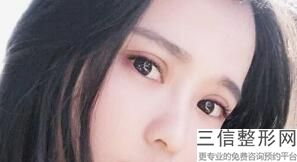 成都割双眼皮十强医院！成都臻爱微美医疗美容医院实力入围