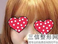 成都隆鼻出名医院有哪些!成都水晶唯罗纳医疗美容门诊部实力超强