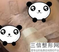 成都隆鼻专家前十名测评来袭！ 肖开宇医生口碑良好