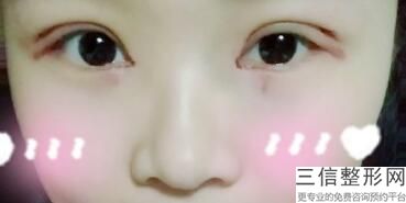 大连做双眼皮整形医院排名前十筛选！大连维恩医疗美容门诊部位列前十