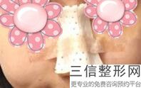 东莞鼻整形医院五大排名！东莞西妃美容医院位列前十